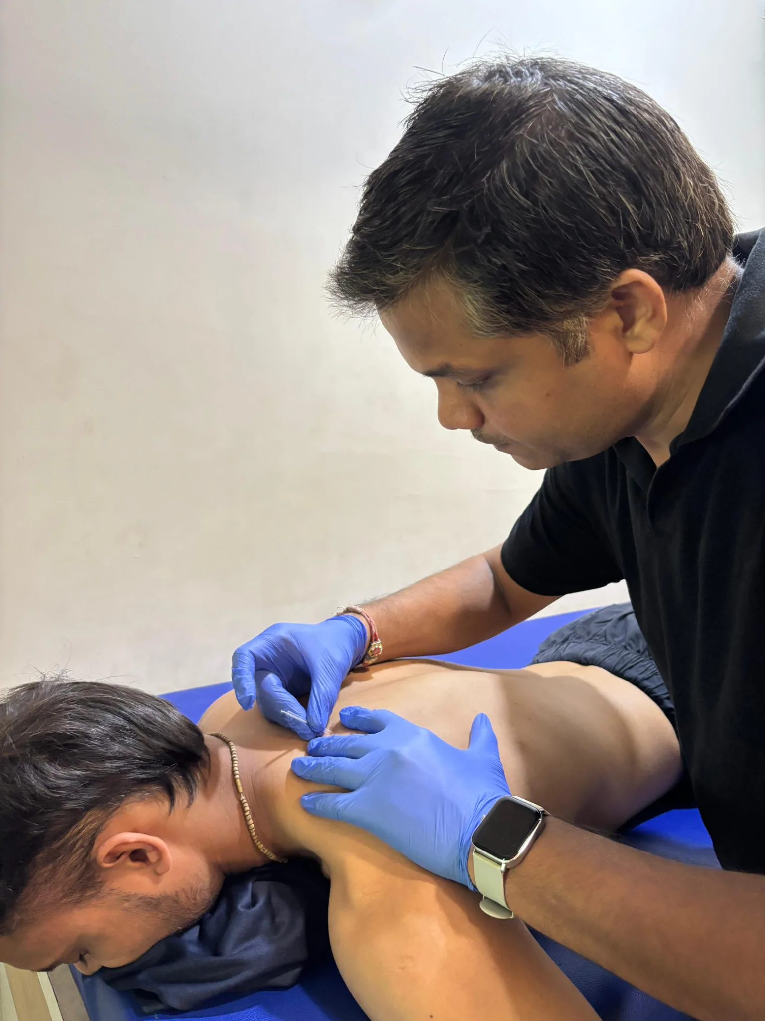 Dry Needling Therapy